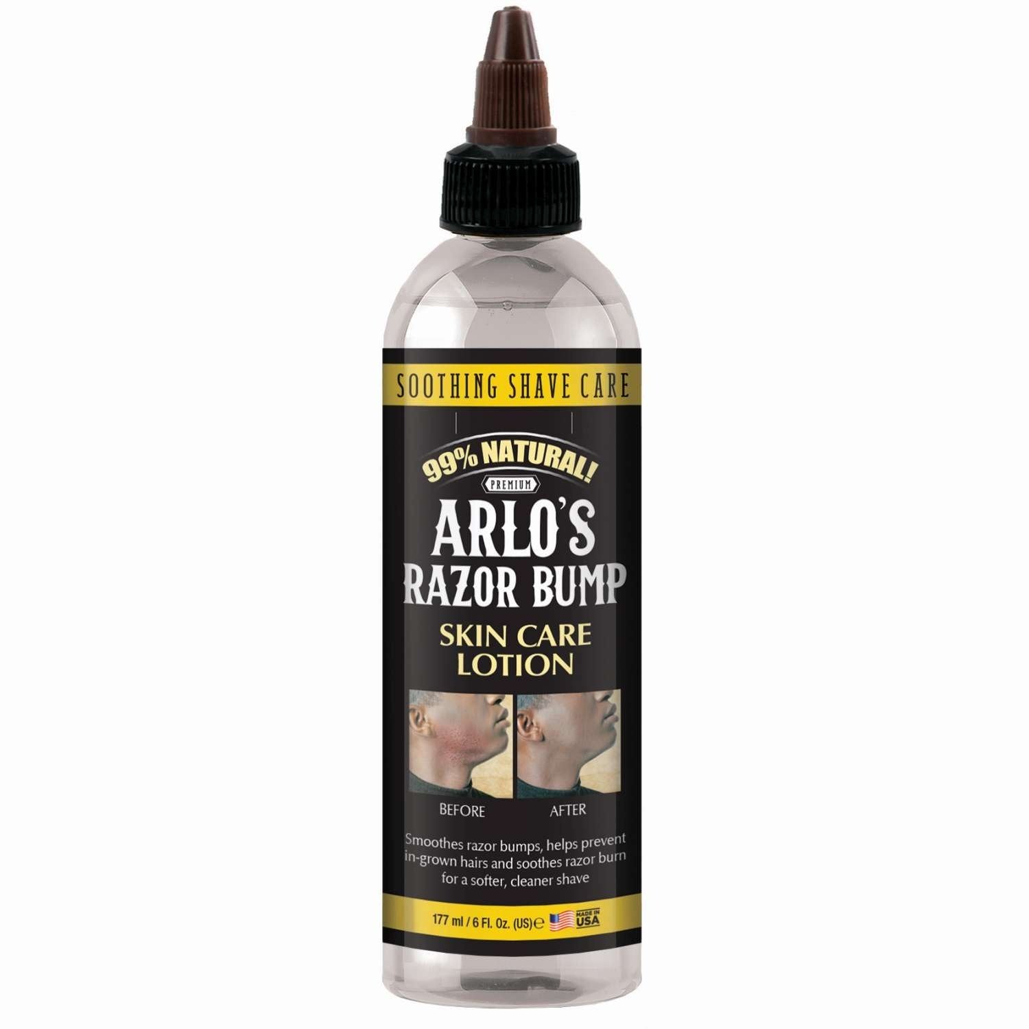 Arlos Razor Bump Skin Care Lotion 6 Oz Arlos Razor Bump Skin Care Lotion 6 Oz Arlos